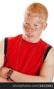 Portrait of an African albino man with heavily freckled lips and skin.
