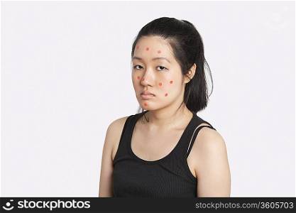 Portrait of an young woman suffering from measles