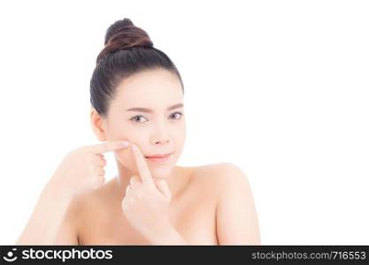 Portrait of beautiful woman asian is a acne, zit treatment, girl problem beautiful face, beauty perfect with wellness isolated on white background with skin healthcare concept.