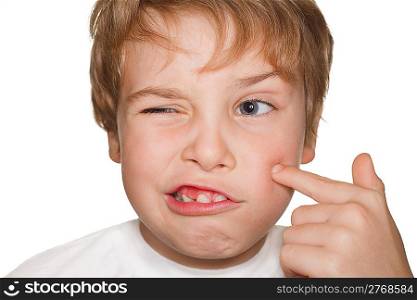 portrait small child in a white t-shirt photography studio,finger indicates pimple. ring flash