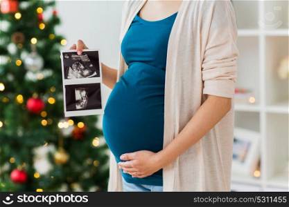 pregnancy, winter holidays and people concept - close up of pregnant woman with baby ultrasound images at christmas. pregnant woman with ultrasound images at christmas