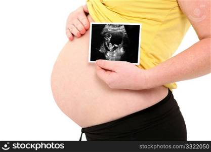 Pregnant woman&acute;s belly and ultrasound over white background.
