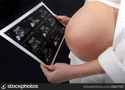 Pregnant woman looking at ultrasound