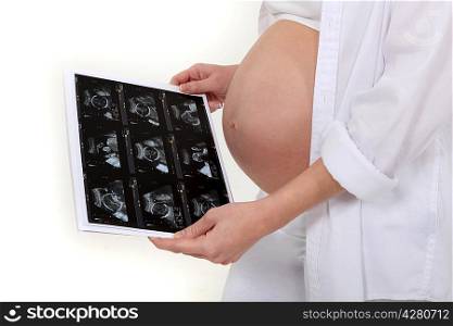 Pregnant woman watching her scan