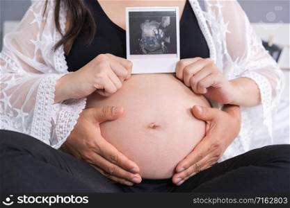 Pregnant woman with her husband holding ultrasound scan