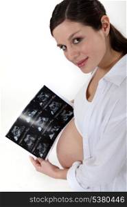 Pregnant woman with ultrasound
