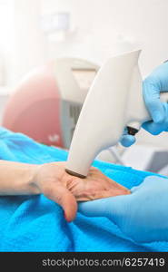 Procedure against hyperhidrosis. Procedure for palm against hyperhidrosis