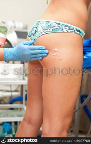 procedure. procedure for women hip against cellulite and fat