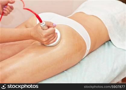 procedure. procedure for women hip against cellulite and fat