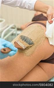 procedure. procedure for women hip for cellulite and fat