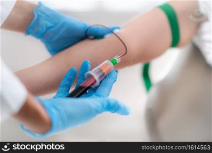 PRP Treatment. Drawing Blood for Platelet Rich Plasma Injection, Aesthetic Medicine Treatment for Reduction of Face Wrinkles.. PRP or Platelet Rich Plasma Treatment, Drawing Blood