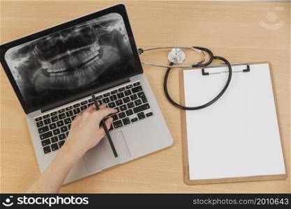 radiography laptop