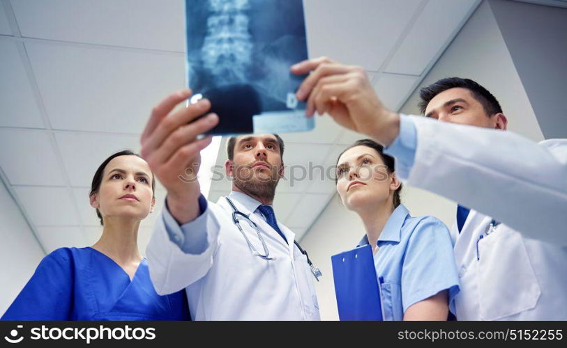radiology, health care, people, surgery and medicine concept - group of doctors looking at x-ray scan image. group of doctors looking at x-ray scan image