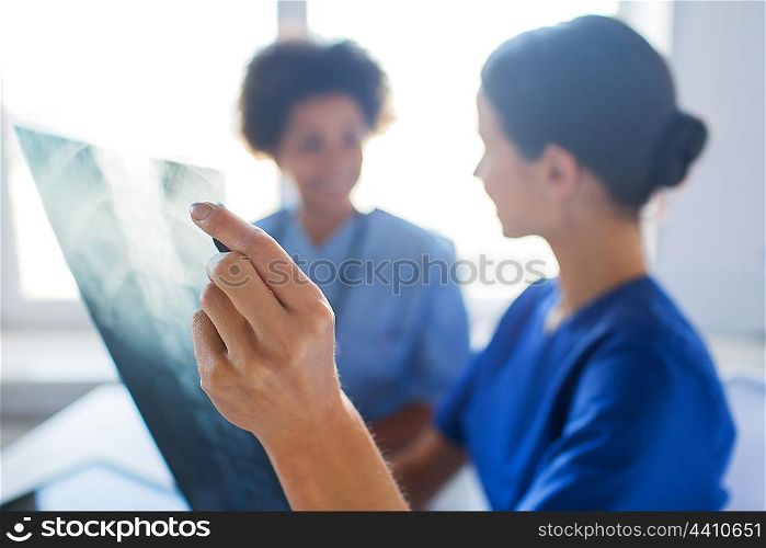 radiology, surgery, people and medicine concept - close up of happy female doctors looking to and discussing x-ray image at hospital