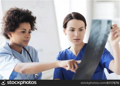 radiology, surgery, people and medicine concept - female doctors looking to and discussing x-ray image at hospital