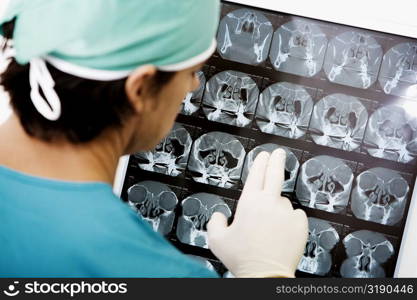 Rear view of a surgeon looking at an X-Ray
