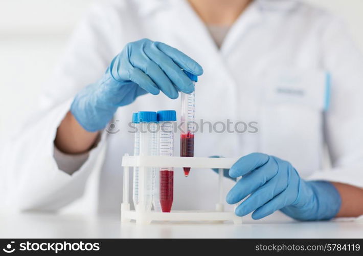 science, chemistry, biology, medicine and people concept - close up of young female scientist holding tube with blood sample making and test or research in clinical laboratory