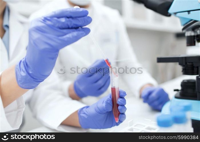 science, chemistry, technology, biology and people concept - close up of scientists hands with pipette and test tube making research in clinical laboratory