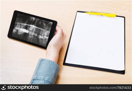 scientist analyzes X-ray picture of human jaws on screen on tablet pc