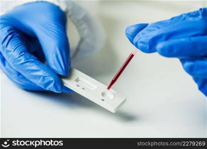 Scientist or doctor placing blood s&le on Rapid Diagnostic Test RDT cassette,medical technician performing quick fast blood PRP testing identifying antibodies for Coronavirus SARS-CoV-2 COVID-19 
