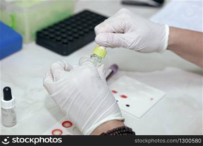 Scientist working in his laboratory. A blood test is a laboratory analysis performed on a blood sample that is usually extracted from a vein in the arm using a hypodermic needle, or via fingerprick.