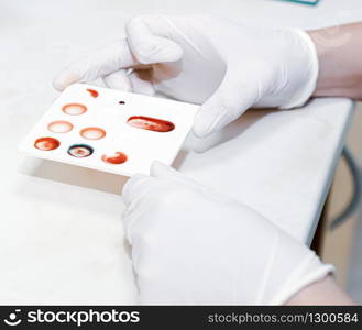 Scientist working in his laboratory. A blood test is a laboratory analysis performed on a blood sample that is usually extracted from a vein in the arm using a hypodermic needle, or via fingerprick.