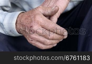 Scraped overworked hands of senior man