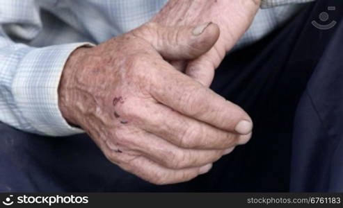 Scraped overworked hands of senior man