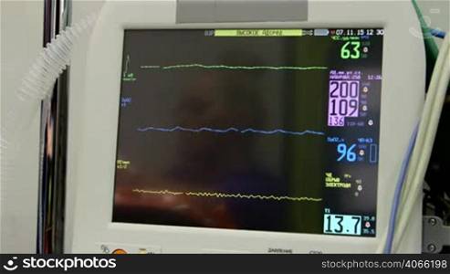 Screen of Russian multiparameter patient monitor in ambulance or hospital with female nurse doctor paramedic reflection