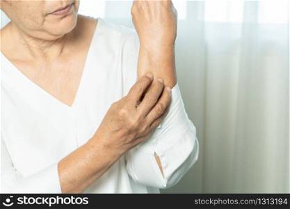 senior women scratch hand the itch on eczema arm, healthcare and medicine concept
