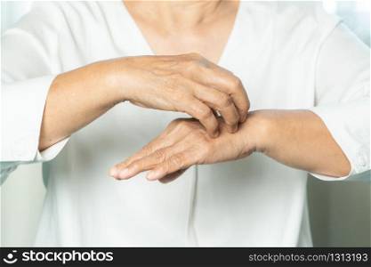 senior women scratch the itch on eczema hand, healthcare and medicine concept