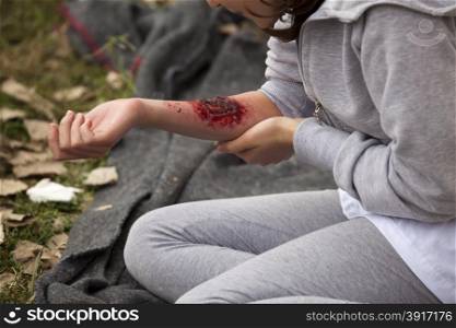 Serious injury on girl&rsquo;s arm