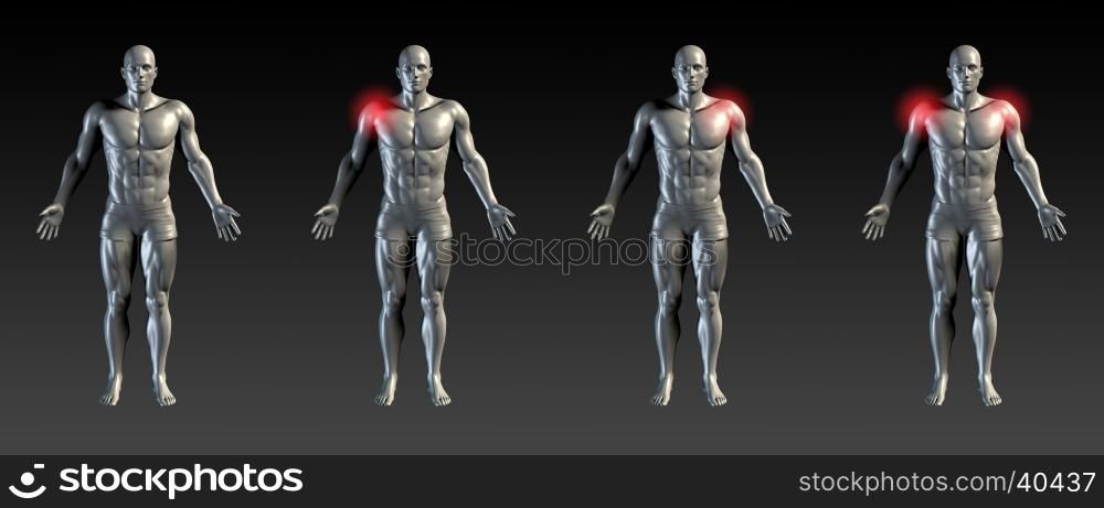 Shoulder Injury with Red Glow on Area Series
