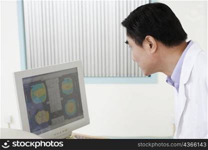 Side profile of a male doctor looking at a computer monitor