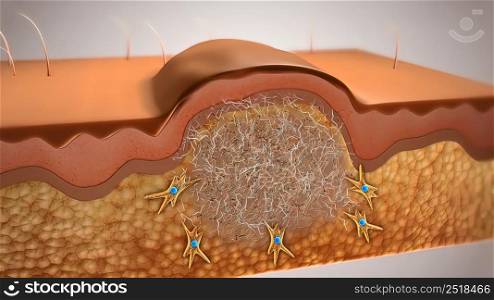 Skin wound healing shows an extraordinary cellular function mechanism, unique in nature and involving the interaction of several cells, growth factors and cytokines. 3D illustration. healing of the wound on the skin