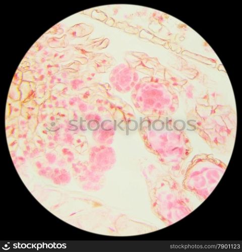Slice fern leaf under a microscope, (Fern Leaf Sec.), 400x