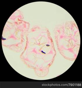 Slice fern leaf under a microscope, (Fern Leaf Sec.), 400x