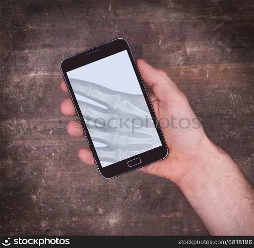 Smartphone display showing an x-ray of the hand holding it