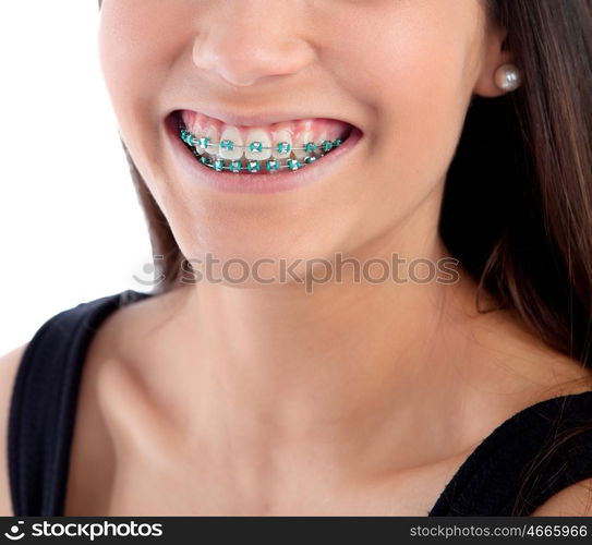 Smiling teenager girl with brackets isolated on a white background