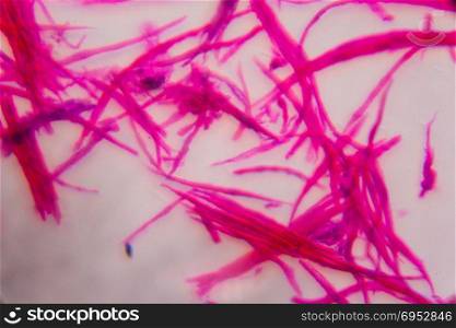 Smooth muscle separate under the microscope - Abstract pink lines on white background.