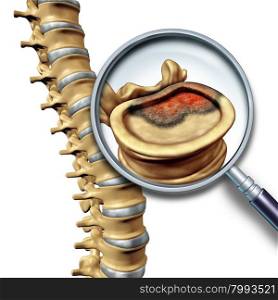 Spine cancer and spinal tumor disease medical concept as skeletal vertebra with a magnifying glass close up of a vertabrate with a cancerous growth.