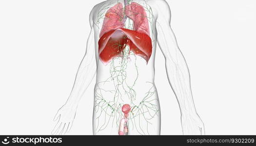 Stage III testicular cancer is characterized by spread to distant lymph nodes or any solid organ. 3D rendering. Stage III testicular cancer is characterized by spread to distant lymph nodes or any solid organ.