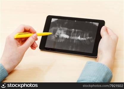 student analyzes X-ray picture of human jaws on screen on tablet pc