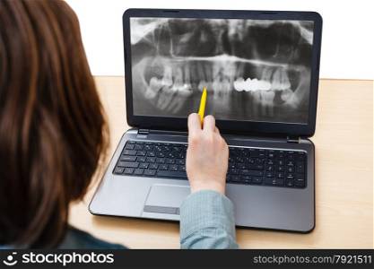 student analyzes X-ray picture of jaws on laptop screen