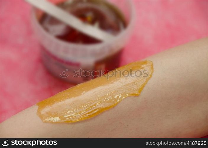 Sugaring: epilation with liquate sugar at legs. It is less painful hair removal with wax replacement