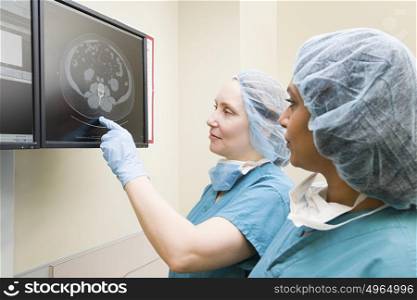 Surgeons looking at scan