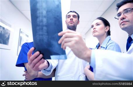 surgery, people, healthcare and medicine concept - group of medics with spine x-ray scan at hospital. group of medics with spine x-ray scan at hospital