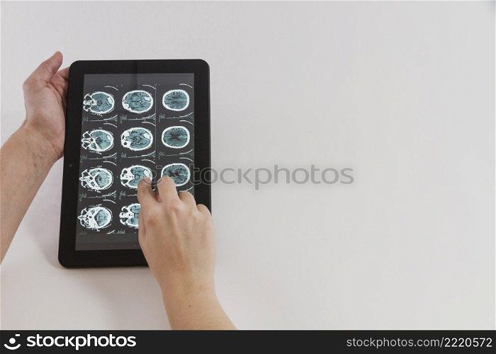 tablet with medical app