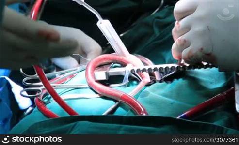 Team of surgeons in uniform performing operation on a patient at cardiac surgery clinic using medical instruments and tools. Medical team operating open heart cardiac bypass surgery in operation room.