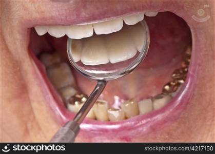 teeth examination